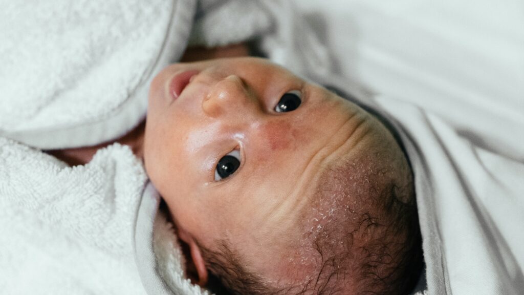 How to Safely bathe a Newborn with Eczema