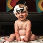 Flat Head Syndrome Treatment, What Parents Need to Know